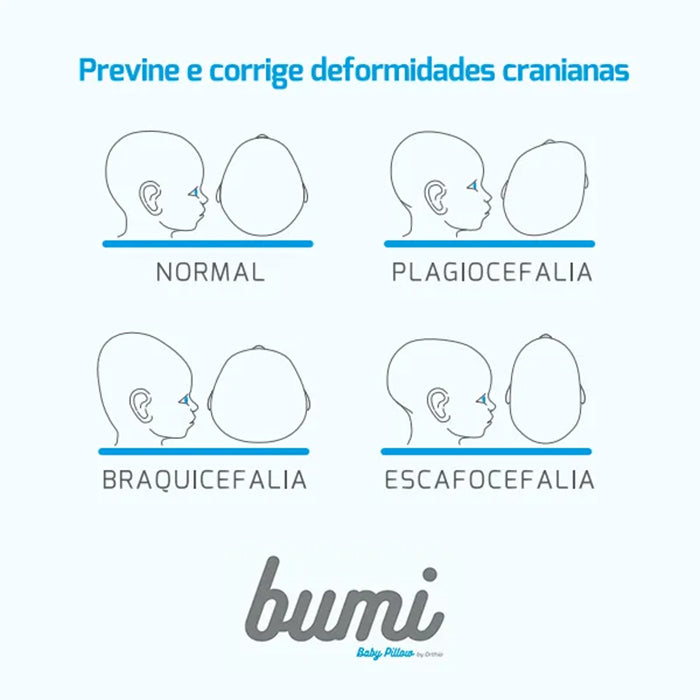 Almofada Para Deformidades Cranianas