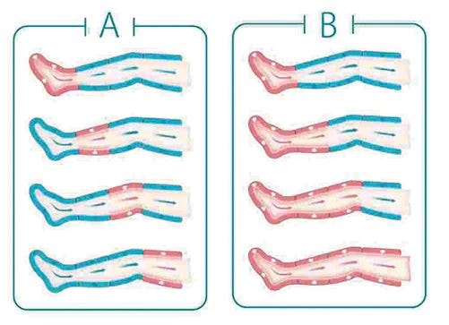 Aparelho De Pressoterapia